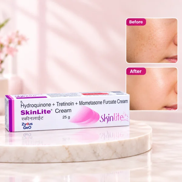 SkinLite Cream