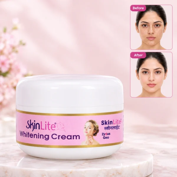 Skinlite Whitening Cream 50g