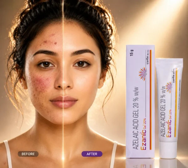 Azelaic Acid Gel 20% w/w Ezanic Gel