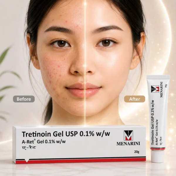 Tretinoin Gel 0.1% 20g
